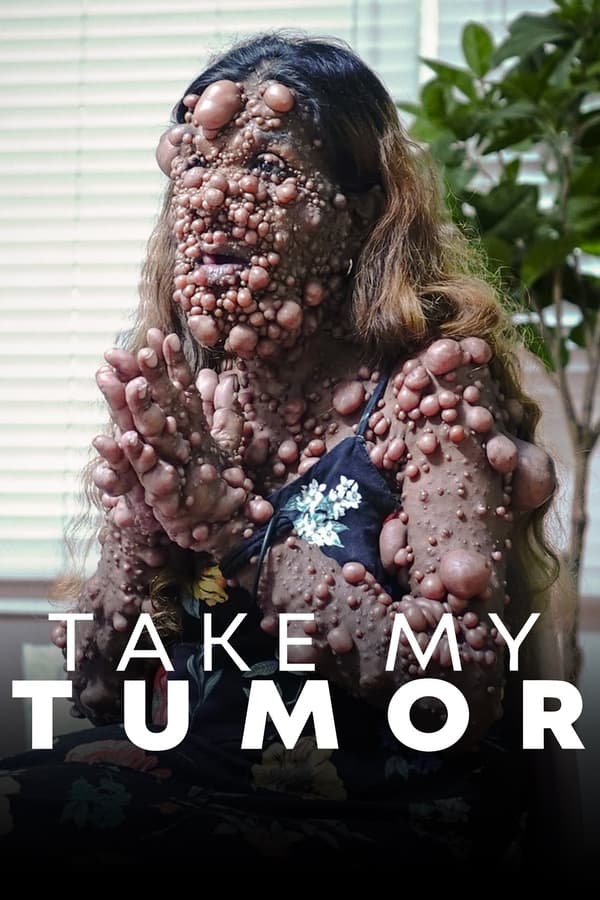 Take My Tumor